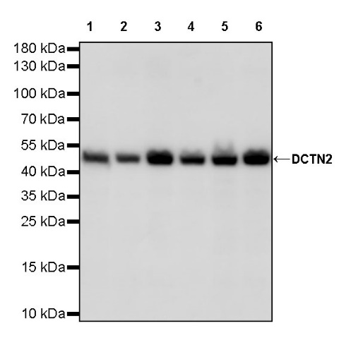 DCTN2 Recombinant Rabbit mAb (S-1082-7)