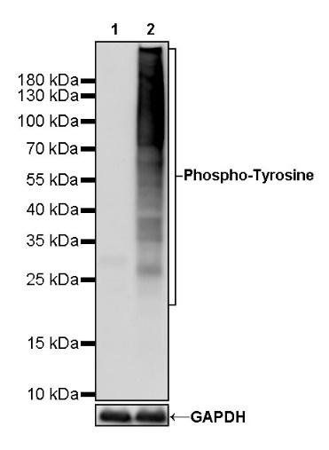 Phosphotyrosine Recombinant Rabbit mAb (S-R207)