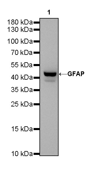 GFAP Recombinant Rabbit mAb (SDT-306-10)