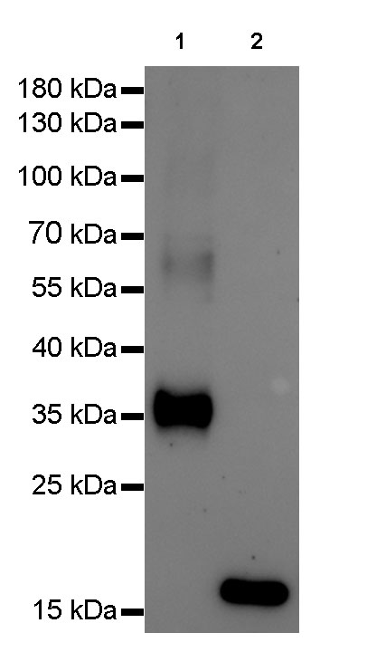 His tag Recombinant Rabbit mAb (SDT-R007)