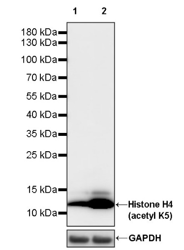 Histone H4 (acetyl K5) Recombinant Rabbit mAb (S-1464-112)