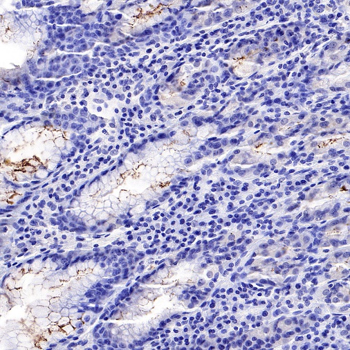 S-RMab® Helicobacter pylori Recombinant Rabbit mAb (HRP Conjugate) (S-R273)