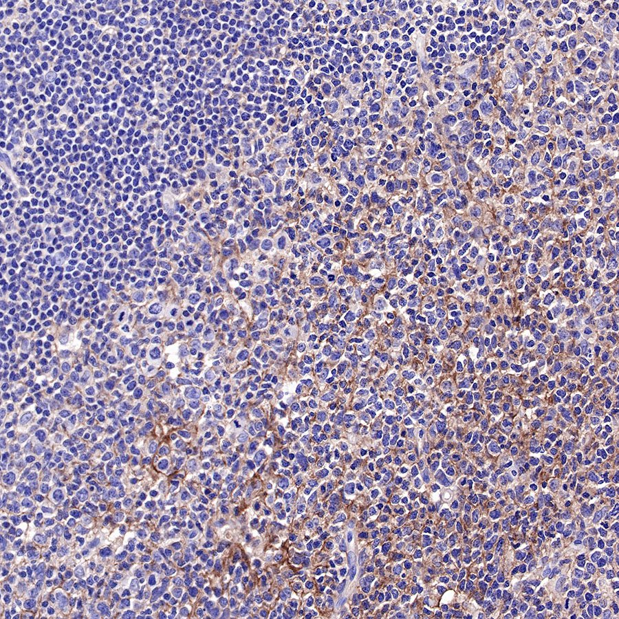 CD81 Recombinant Rabbit mAb (SDT-144-22)