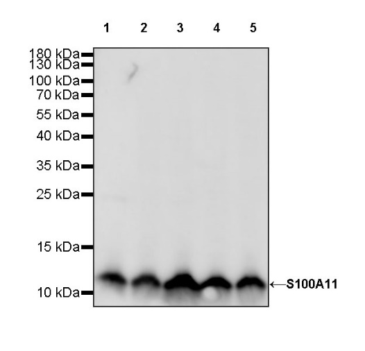 S100A11 Recombinant Rabbit mAb (S-821-4)