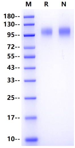 GP120 (group M/subtype B/Isolate MN) His Tag, HIV-1