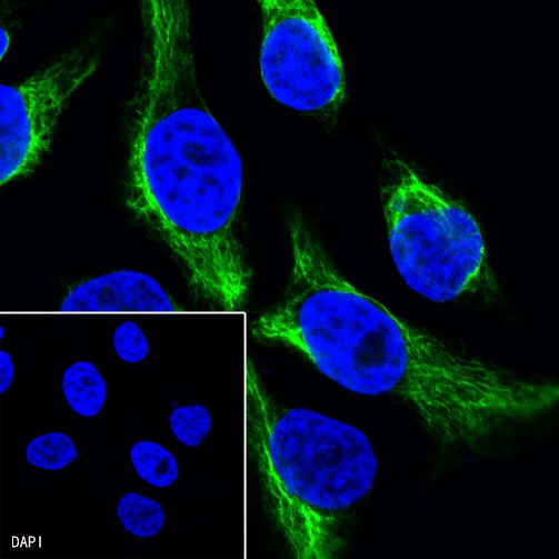 Vimentin Recombinant Rabbit mAb (Alexa Fluor® 488 Conjugate) (S-029-20)