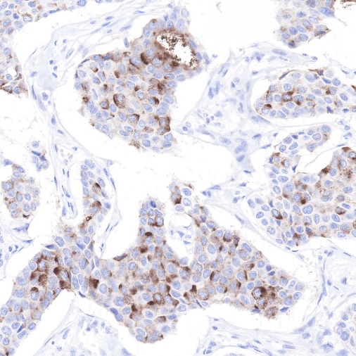 S-RMab® GCDFP-15 Recombinant Rabbit mAb (SDT-R030)