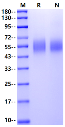 IL-13RA1 His Tag Protein, Human