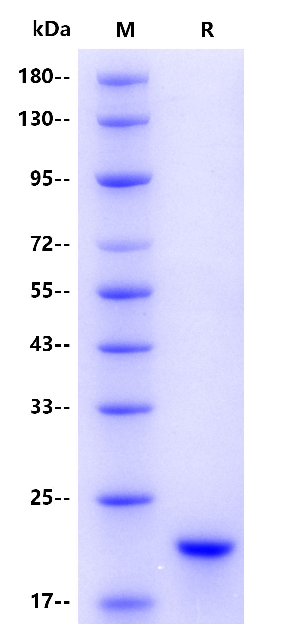 Human Myoglobin, His Tag
