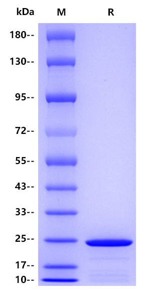 Human RBP4 , His tag