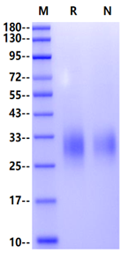 TREM2 His Tag Protein, Human