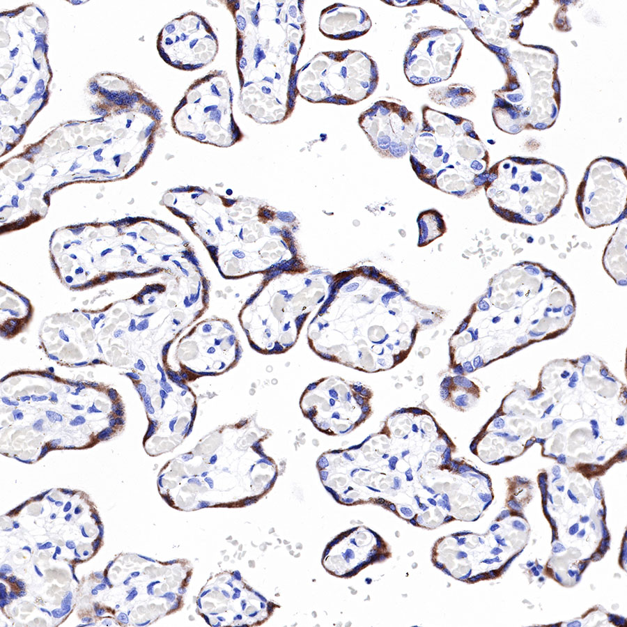 PAPP-A Recombinant Rabbit mAb (SDT-226-46)
