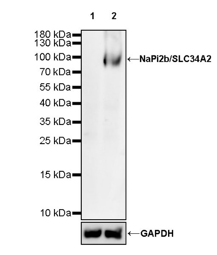 NaPi2b/SLC34A2 Recombinant Rabbit mAb (SDT-R229)