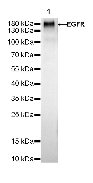 EGFR Recombinant Rabbit mAb (SDT-R110)