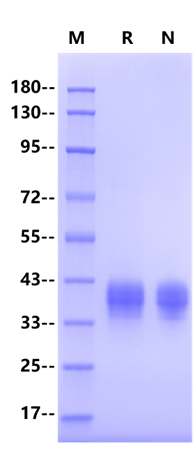 Angiopoietin-like 4/ANGPTL4 His Tag Protein, Human