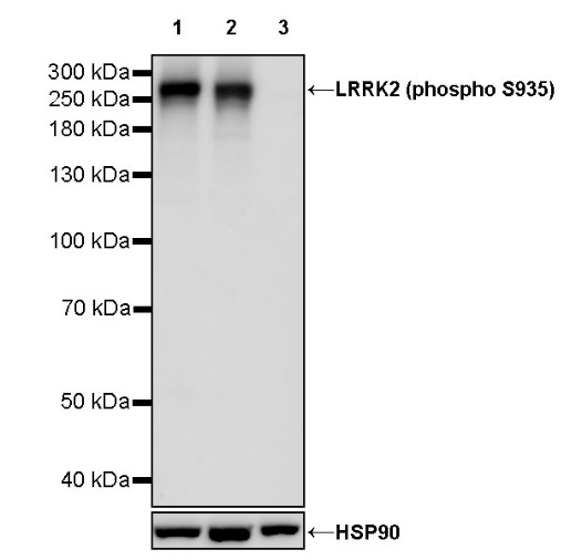 LRRK2 (phospho S935) Recombinant Rabbit mAb (S-966-37)