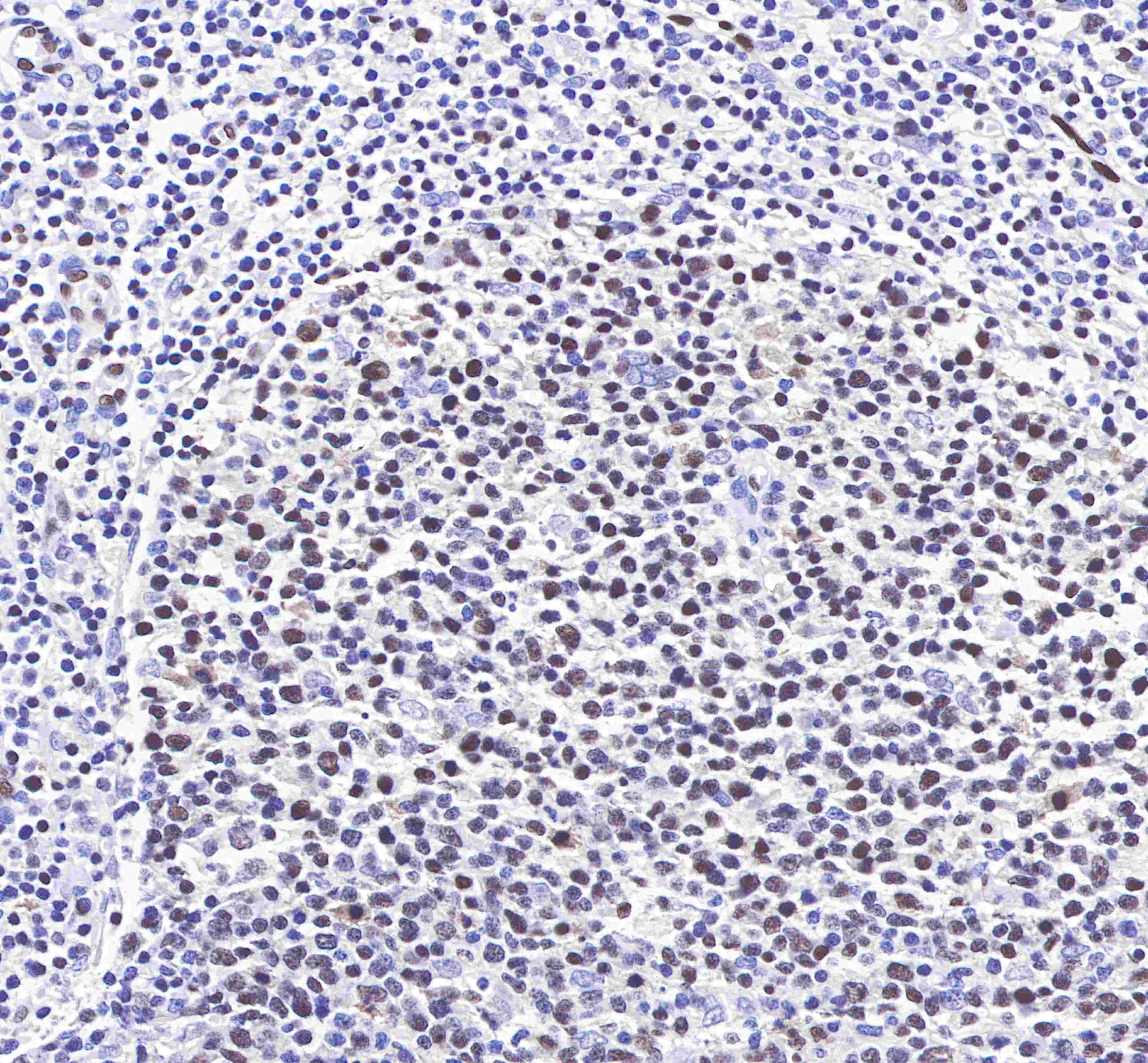 LMO2 Recombinant Rabbit mAb (SDT-017-79)