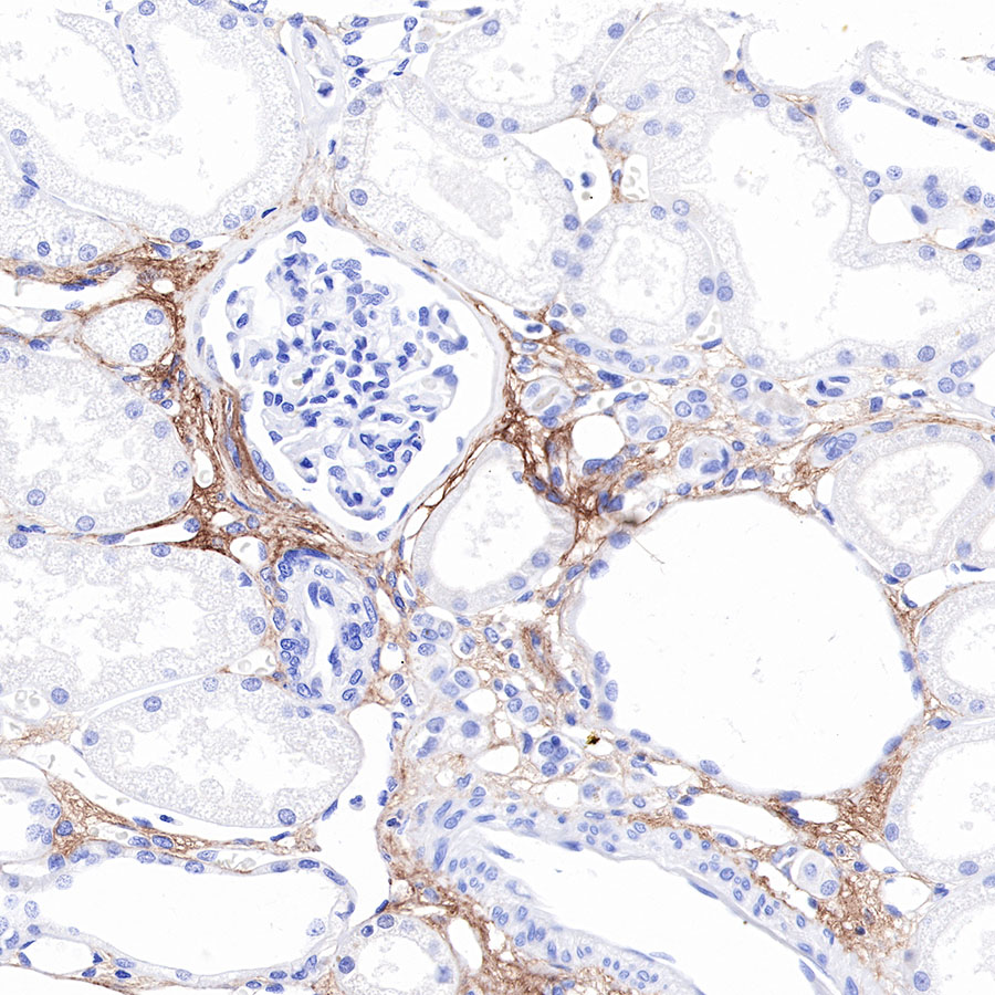 COL3A1(PIIINP) Recombinant Rabbit mAb (SDT-149-50)