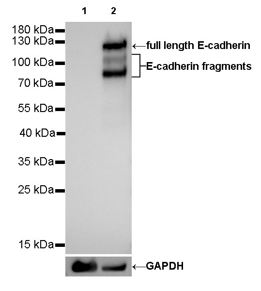 S-RMab® E-Cadherin Recombinant Rabbit mAb (SDT-R088)