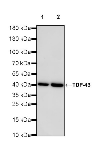 TDP-43 Recombinant Rabbit mAb (S-989-41)