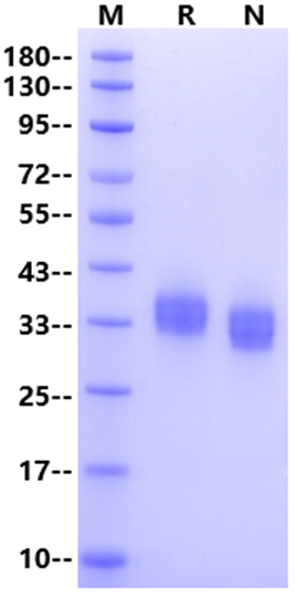 PD-L1/B7-H1 His Tag Protein, Cynomolgus