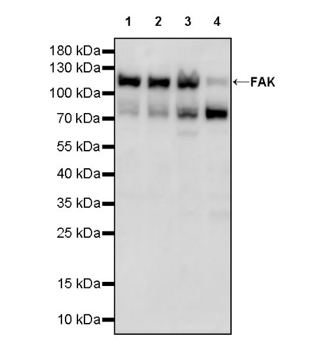 FAK Recombinant Rabbit mAb (S-1180-10)