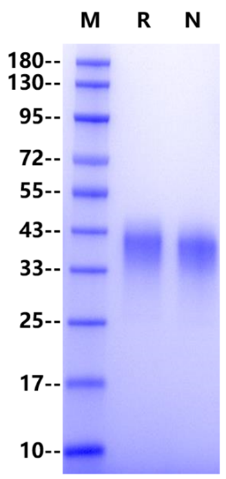PD-1 His Tag Protein, Mouse