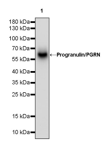 Progranulin/PGRN Recombinant Rabbit mAb (S-1090-110)