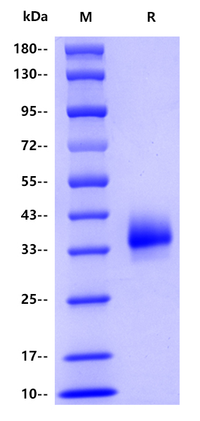 Human CD2, His tag 