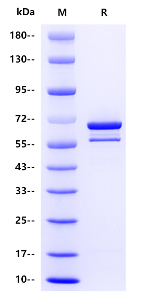 Influenza B virus NP（strainB/Victoria/1308/2005）, His tag 
