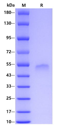 Human Thrombomodulin, His tag