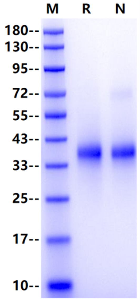 Siglec-15 His Tag Protein, Mouse