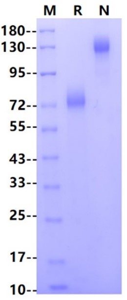 Siglec-2/CD22 Fc Chimera Protein, Human