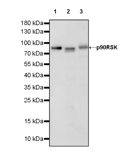 p90RSK Recombinant Rabbit mAb (S-1024-26)