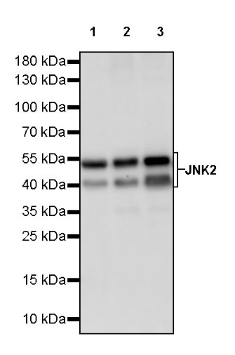 JNK2 Recombinant Rabbit mAb (S-1021-46)