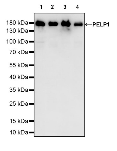 PELP1 Recombinant Rabbit mAb (S-756-22)