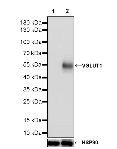 Vesicular Glutamate Transporter 1 (VGLUT1) Recombinant Rabbit mAb (S-1118-58)