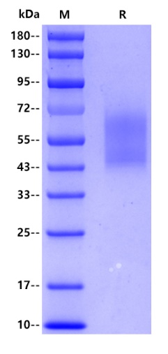 Human CD44s, His tag