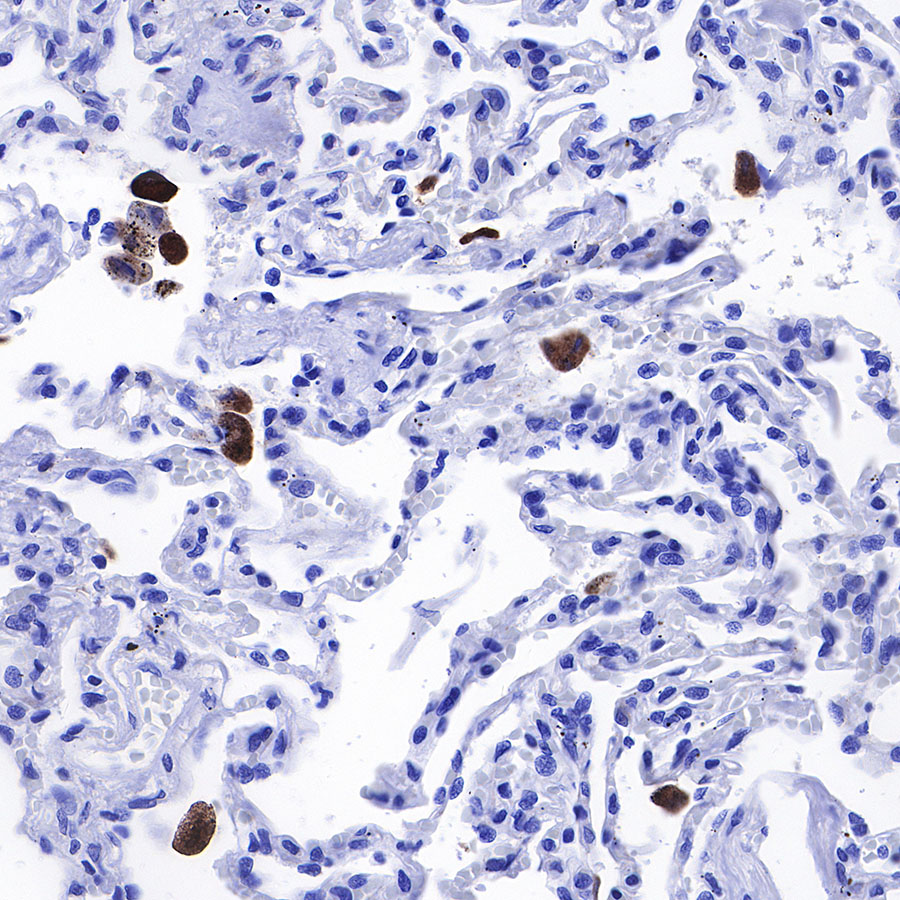 iNOS Recombinant Rabbit mAb (SDT-R131)