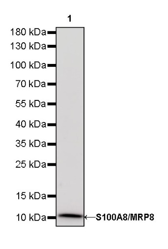 S100A8/MRP8 Recombinant Rabbit mAb (S-R251)