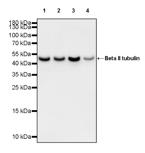Beta II tubulin Recombinant Rabbit mAb (S-1055-2)