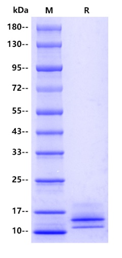 Human MCP1/CCL2 Protein, His tag
