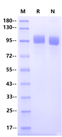 NG2/CSPG4 His Tag Protein, Human