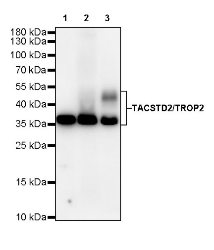 TACSTD2/TROP2 Recombinant Rabbit mAb (S-R237)