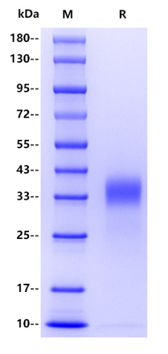 Human CHOP/DDIT3 Protein, His tag
