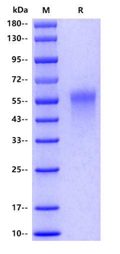 Mouse TIM-1 Protein, His tag