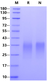ACVR2B His Tag Protein, Human