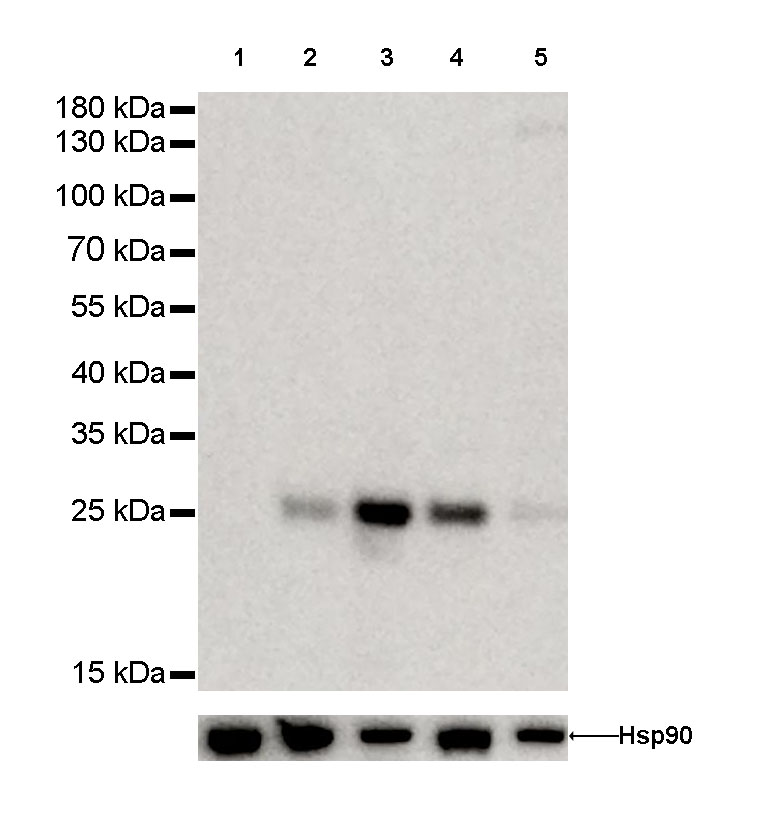 Bcl-2 Recombinant Rabbit mAb (SDT-005-24)