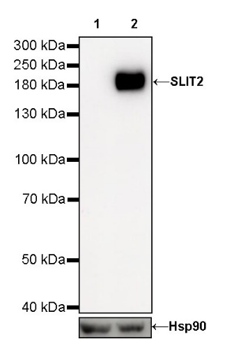 SLIT2 Recombinant Rabbit mAb (S-730-41)