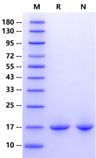 FABP5 His Tag Protein, Human